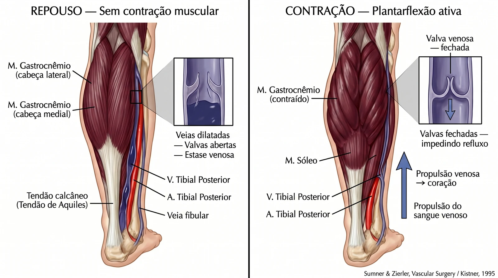 Fig. 6 — Bomba muscular da panturrilha