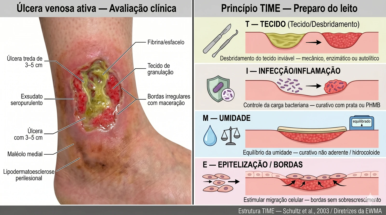 Fig. 7 — Preparo do leito da ferida (princípio TIME)