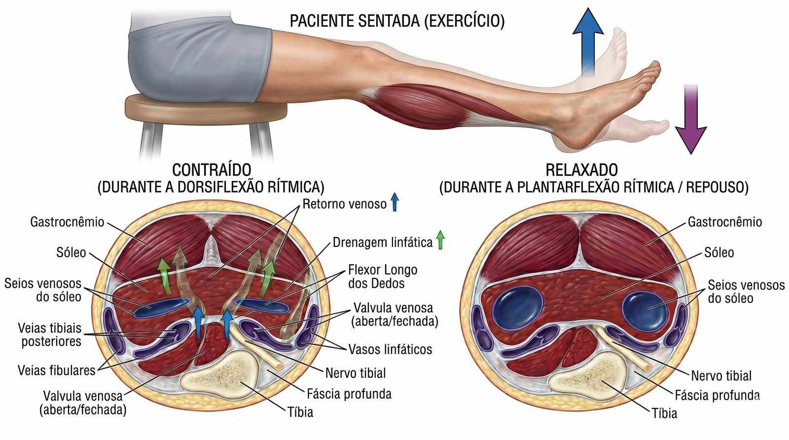 Fig. 4 — Execução de ankle pumps: dorsiflexão e plantarflexão rítmicas para ativação da bomba muscular da panturrilha.